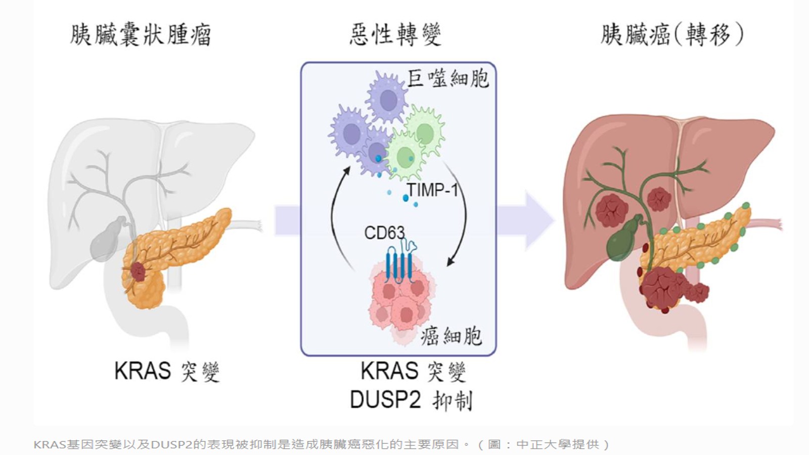 成大、中正聯手！解開胰臟癌細胞惡化及免疫特權的機制